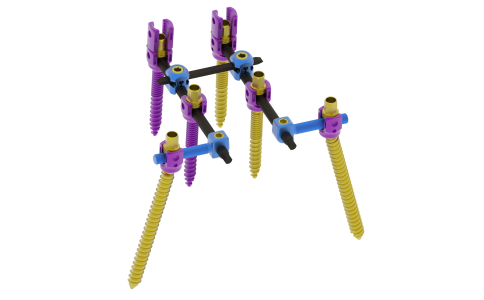 脊柱內固定系統（5.5）